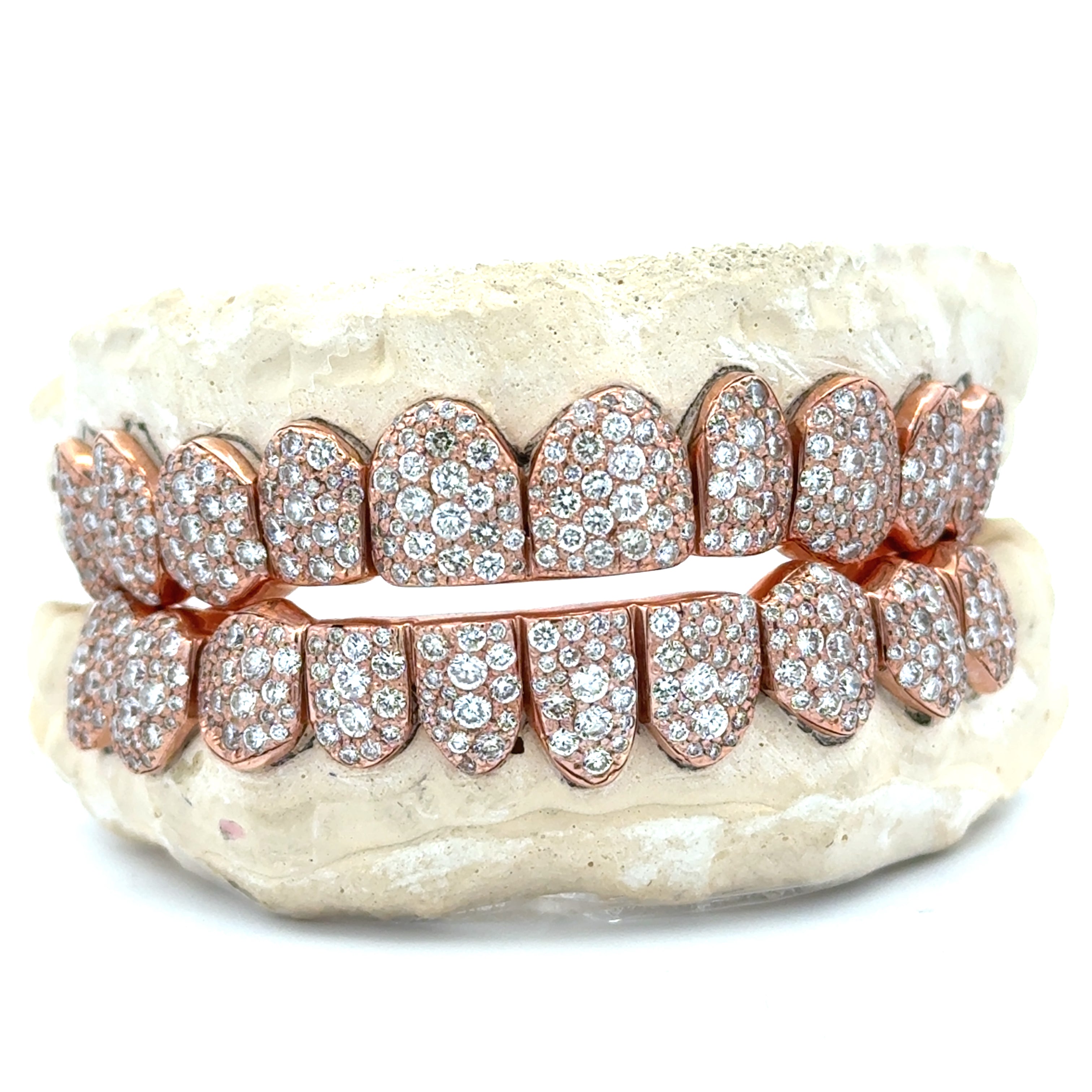 New Mosaic Setting Grillz